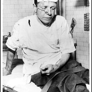 photo of New York CORE member James Peck, beaten for being a Freedom Rider